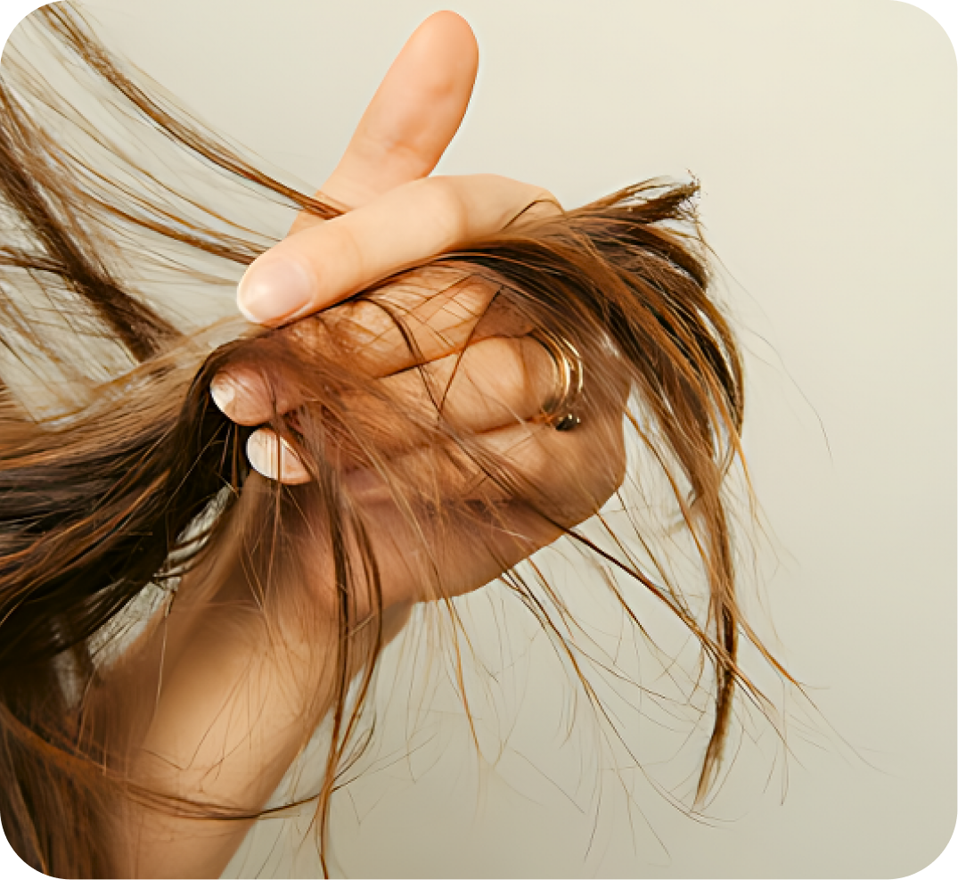 تساقط الأطراف