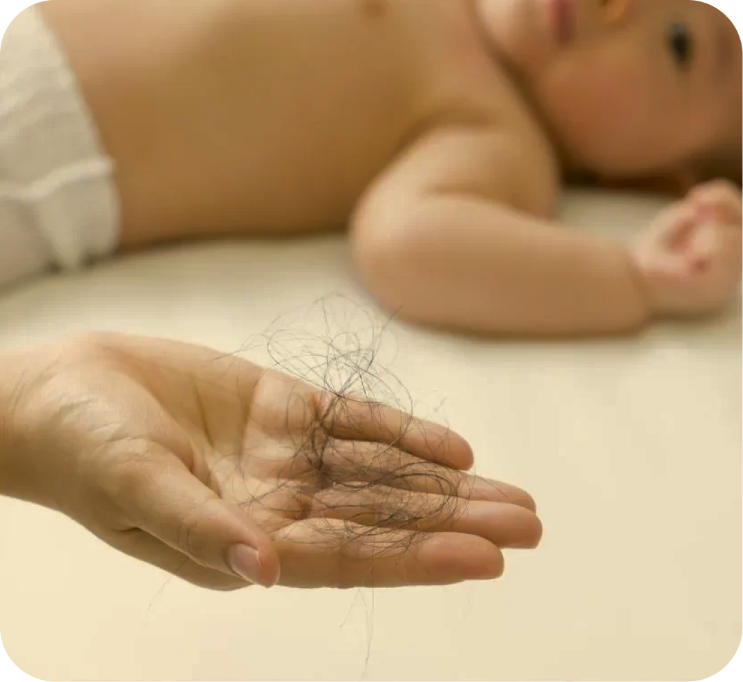 ما بعد الولادة