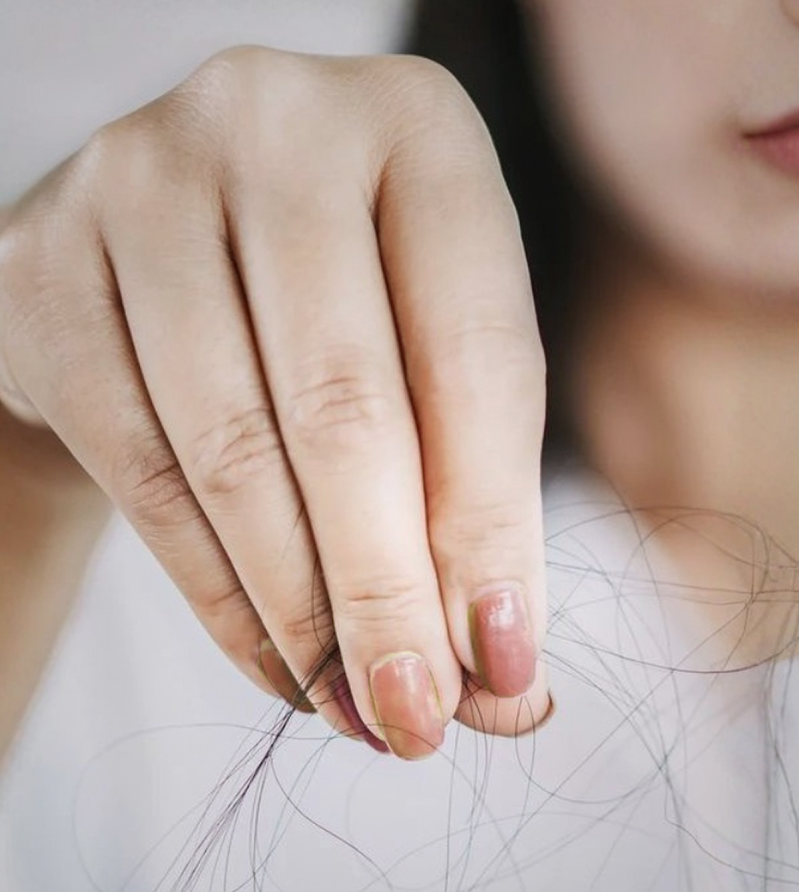 امرأة تمسك شعراً متساقطاً