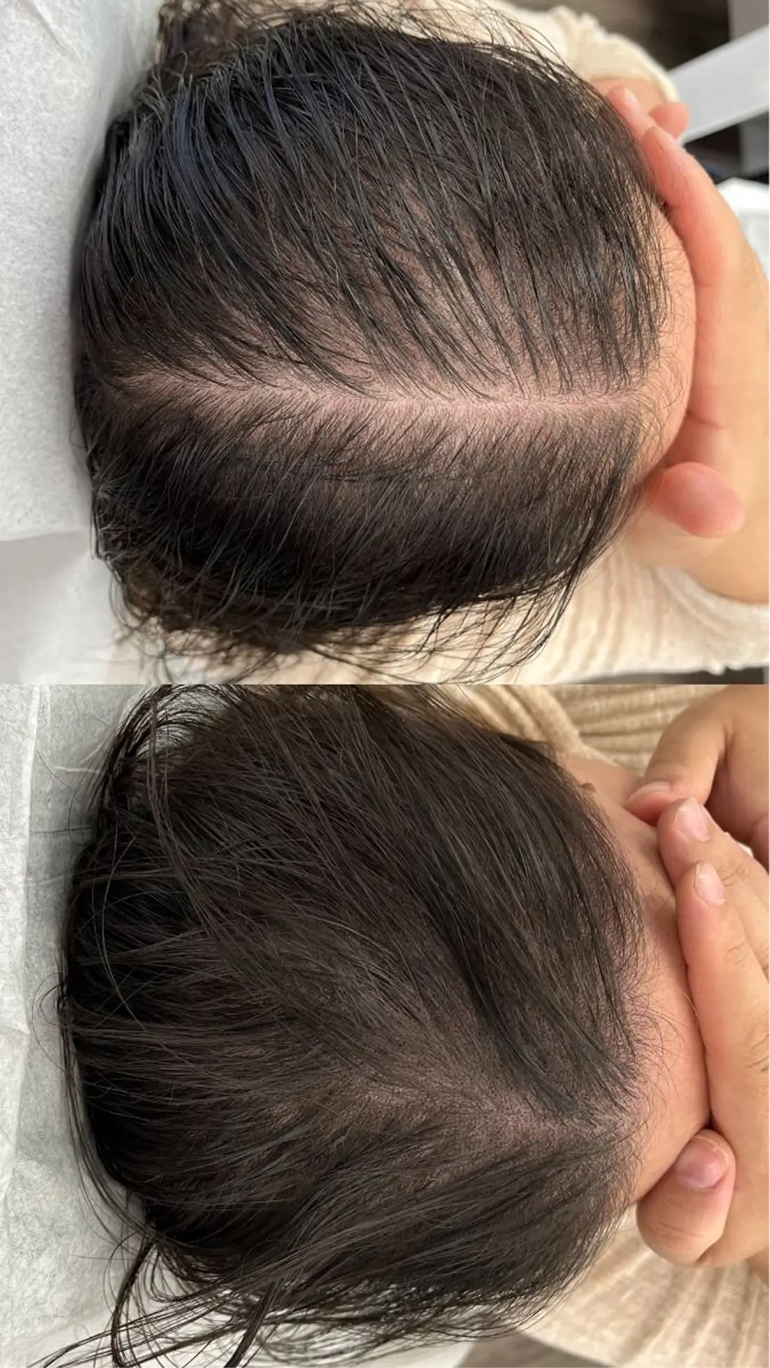 نتيجة حقيقية لزبونة كاميليا — قبل وبعد